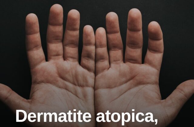 Dermatite atopica, “Diari atipici” dà voce ai pazienti